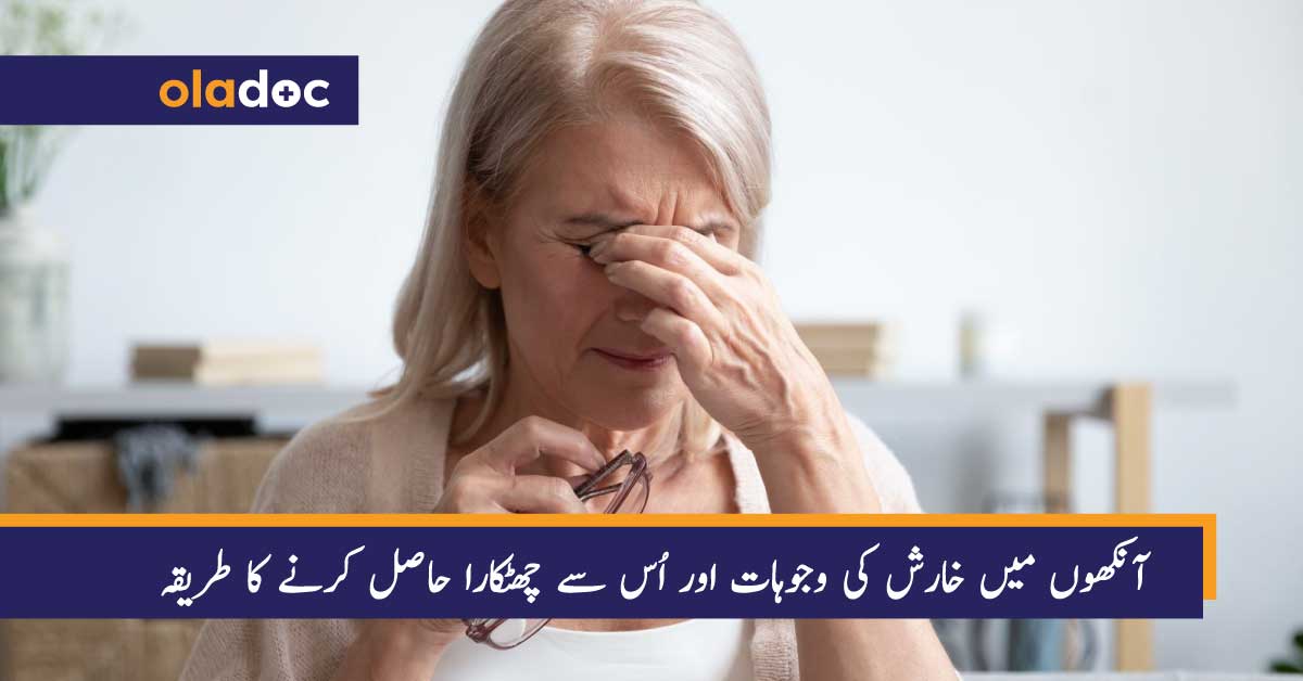 آنکھوں میں خارش کی وجوہات اور اُس سے چھٹکارا حاصل کرنے کا طریقہ thumbnail