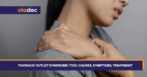 thoracic-outlet-syndrome