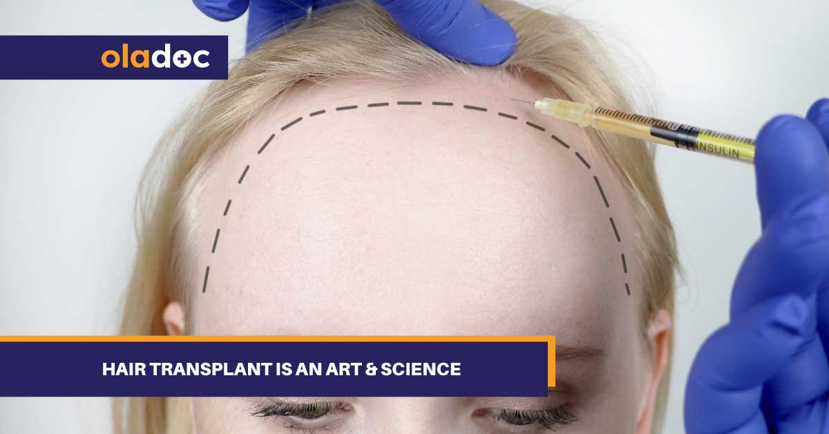 Hair Transplant Is An Art & Science thumbnail