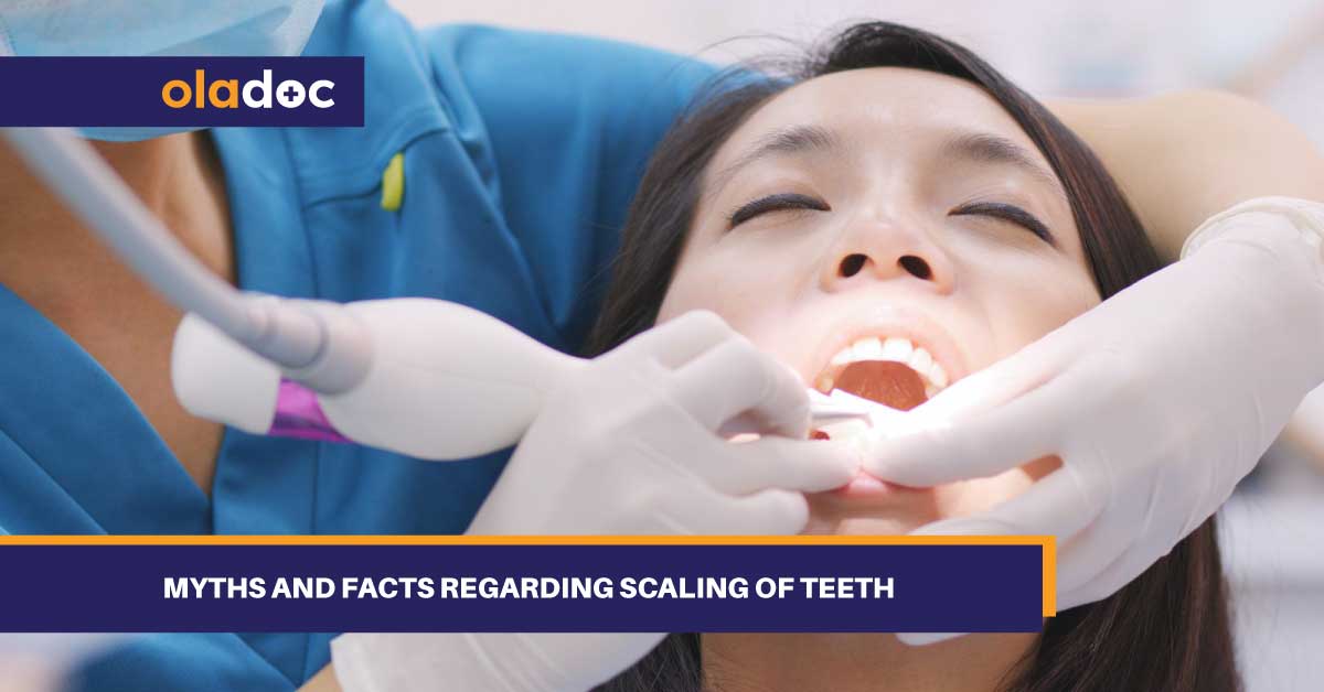 Myths And Facts Regarding Scaling Of Teeth thumbnail