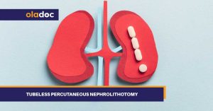 Tubeless Percutaneous Nephrolithotomy