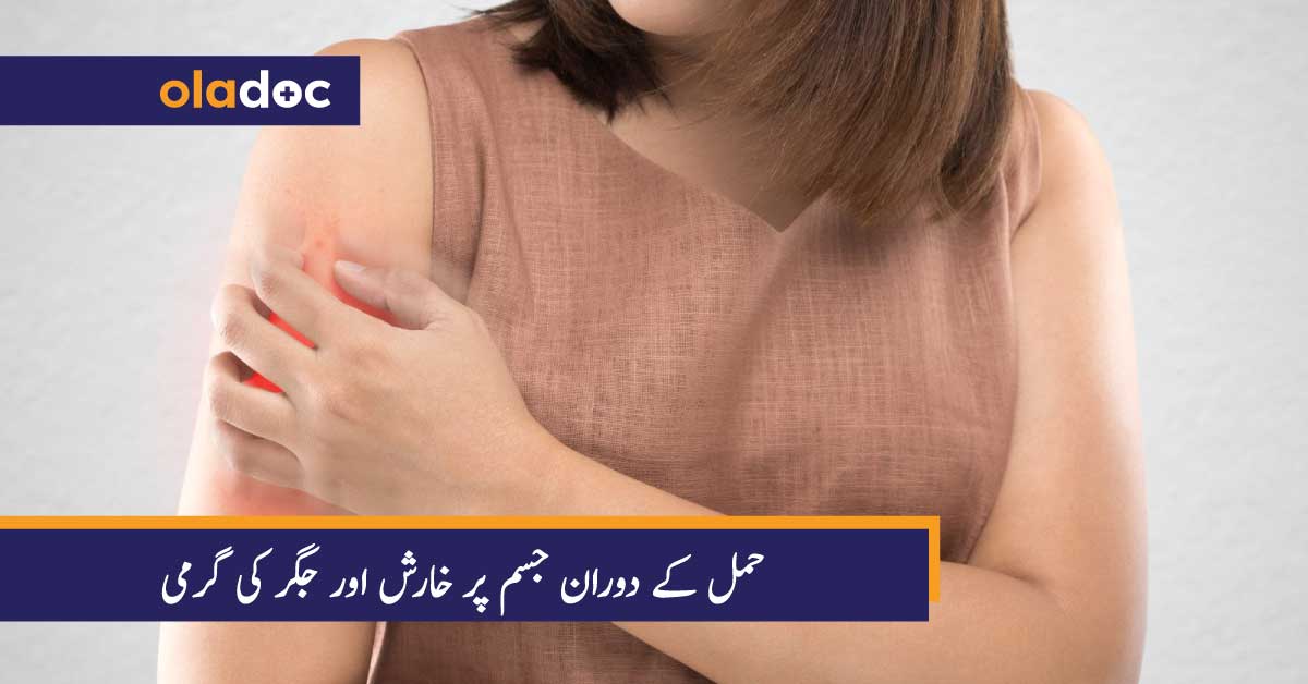 حمل کے دوران جسم پر خارش اور جگر کی گرمی thumbnail