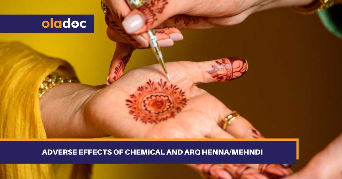 Adverse Effects of Chemical and Arq Henna/Mehndi thumbnail