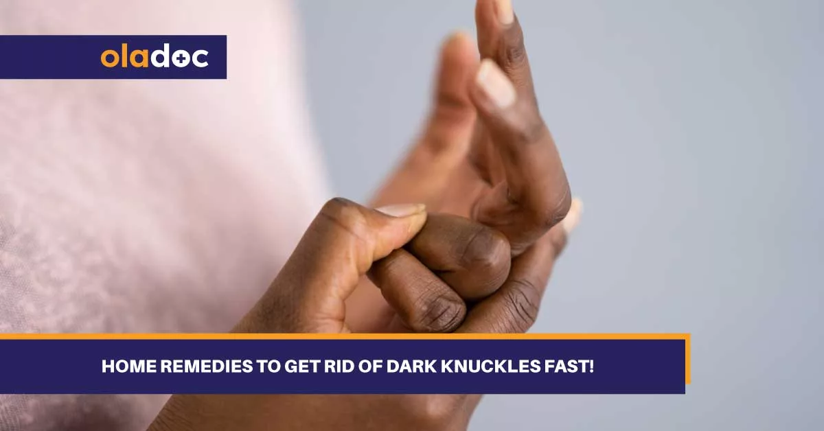 Home Remedies To Get Rid Of Dark Knuckles Fast!