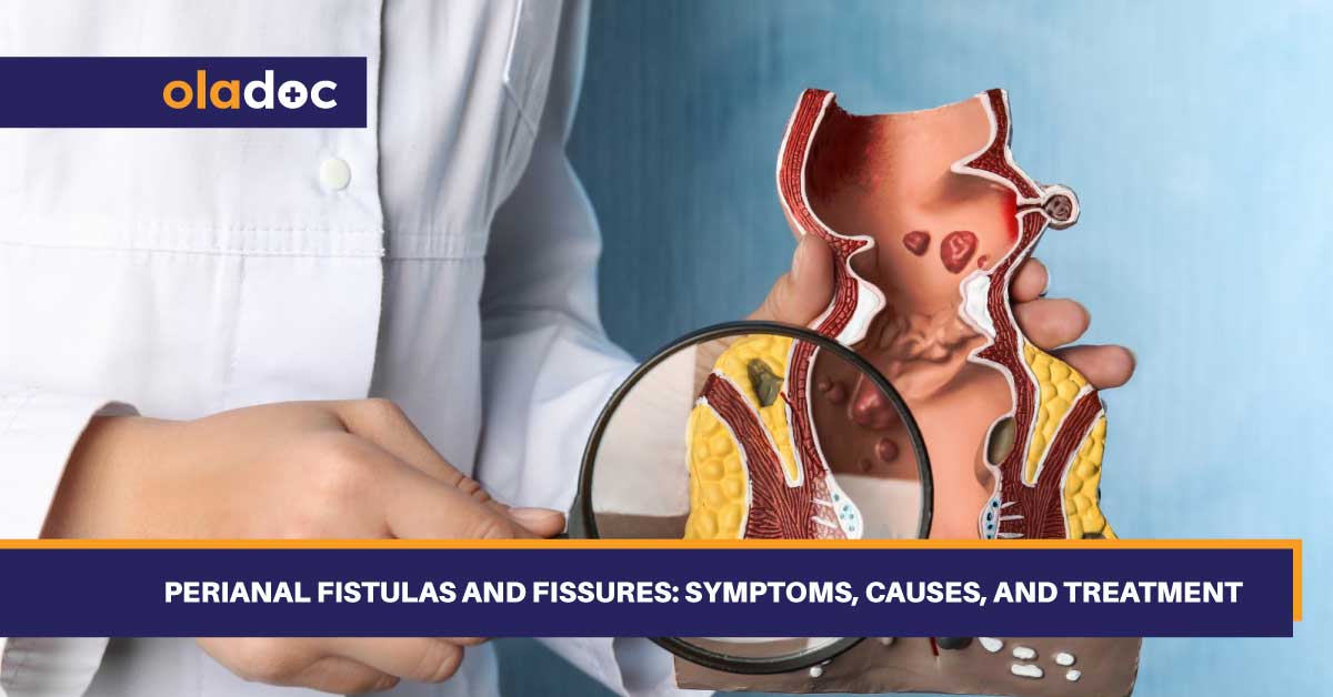 Perianal Fistulas and Fissures: Symptoms, Causes, and Treatment thumbnail