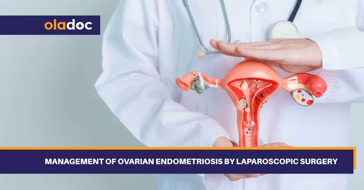Management Of Ovarian Endometriosis by Laparoscopic Surgery thumbnail