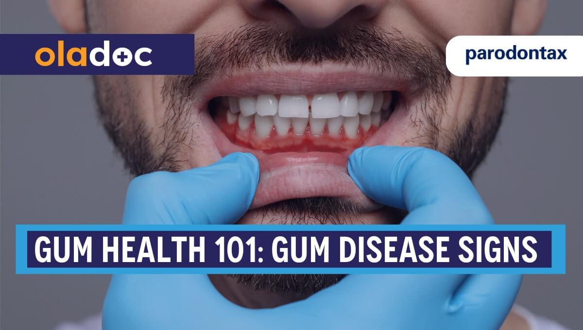 Gum Health 101: Recognizing The Warning Signs Of Gum Disease thumbnail
