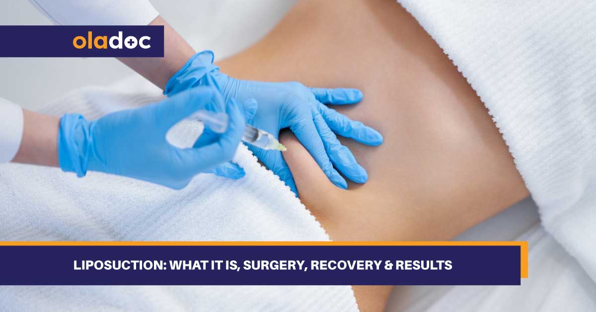 Liposuction: What It Is, Surgery, Recovery & Results thumbnail