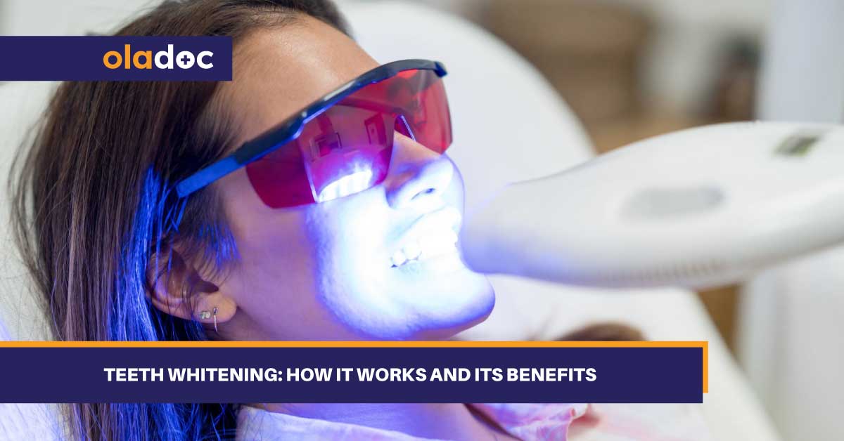 Teeth Whitening: How It Works And Its Benefits thumbnail