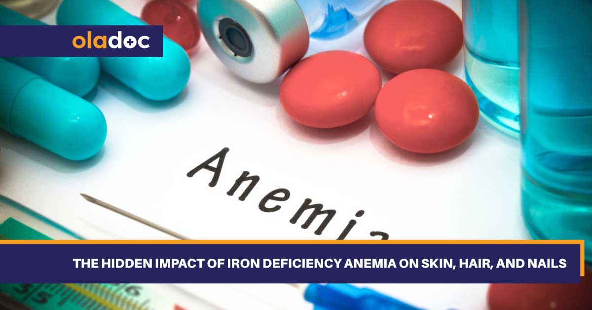 The Hidden Impact of Iron Deficiency Anemia on Skin, Hair, and Nails thumbnail