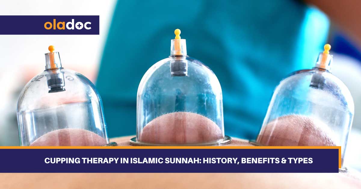 Cupping Therapy in Islamic Sunnah: History, Benefits & Types thumbnail