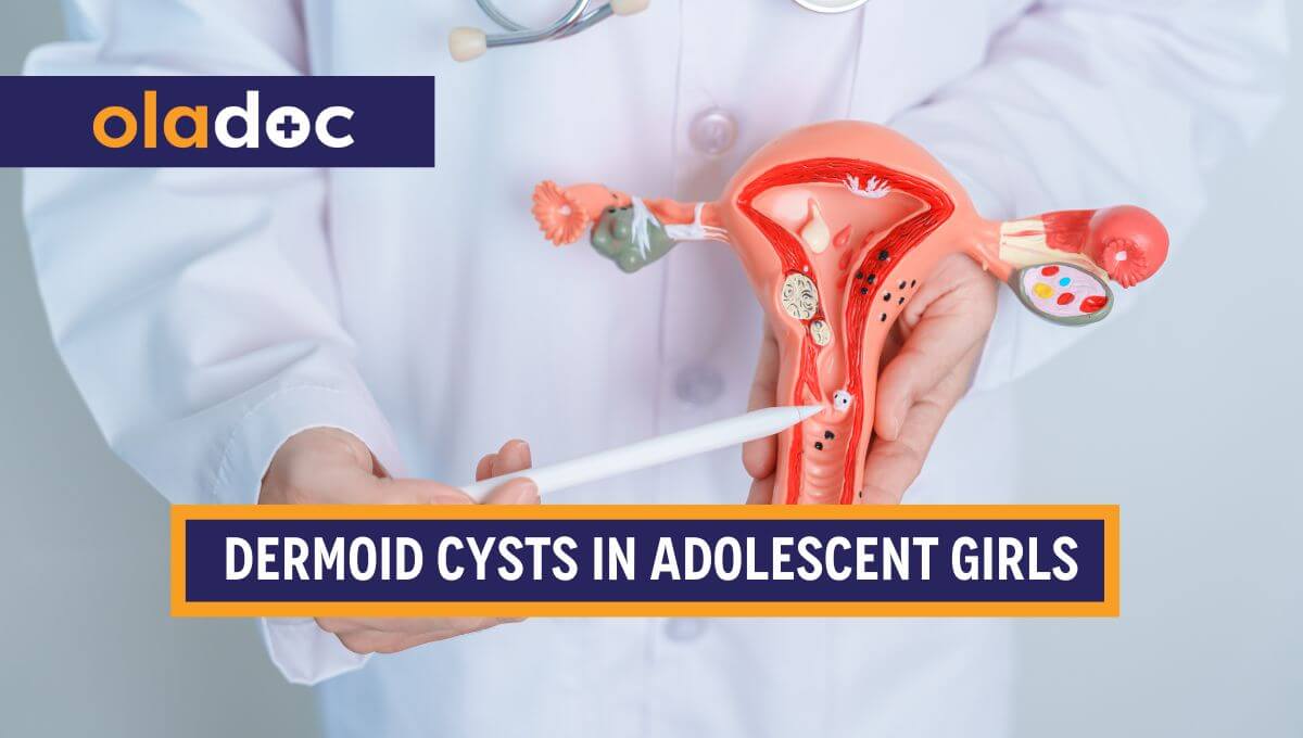 Dermoid Cysts In Adolescent Girls - Causes, Symptoms & Treatment thumbnail