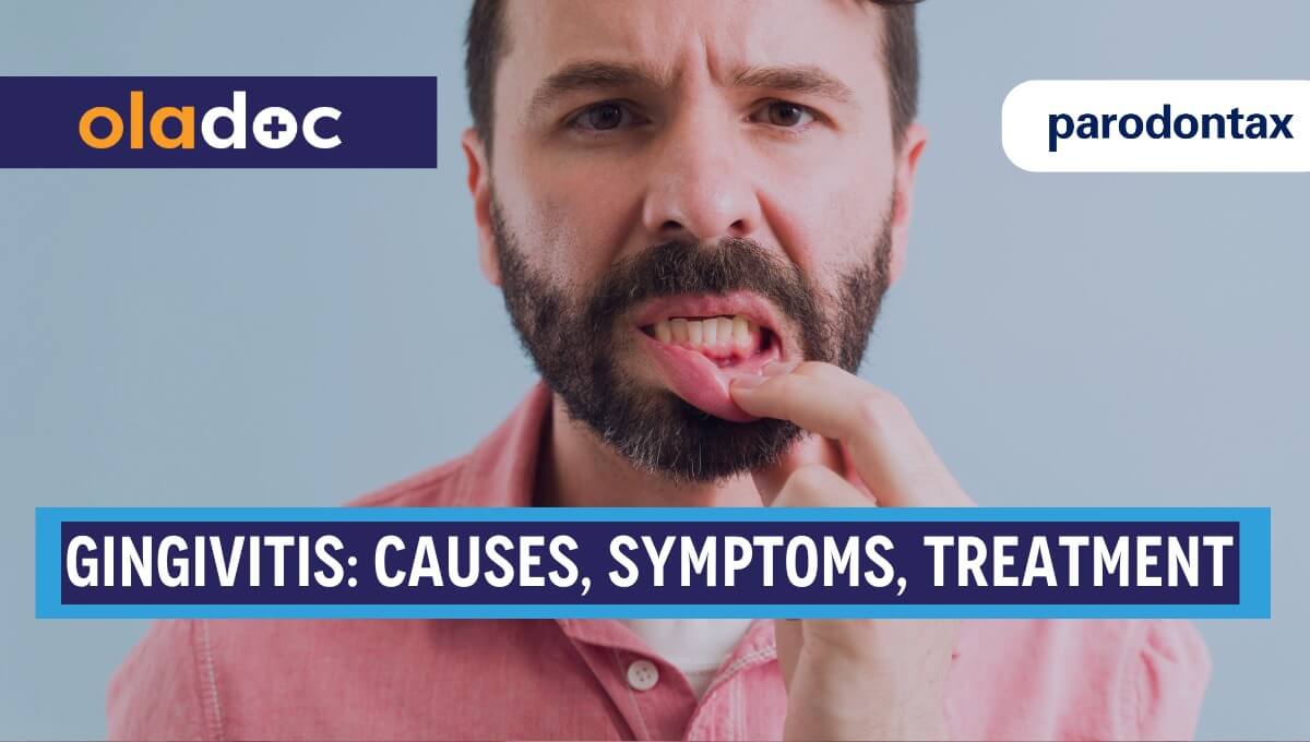 Understanding Gingivitis: A Comprehensive Guide for Gum Health thumbnail
