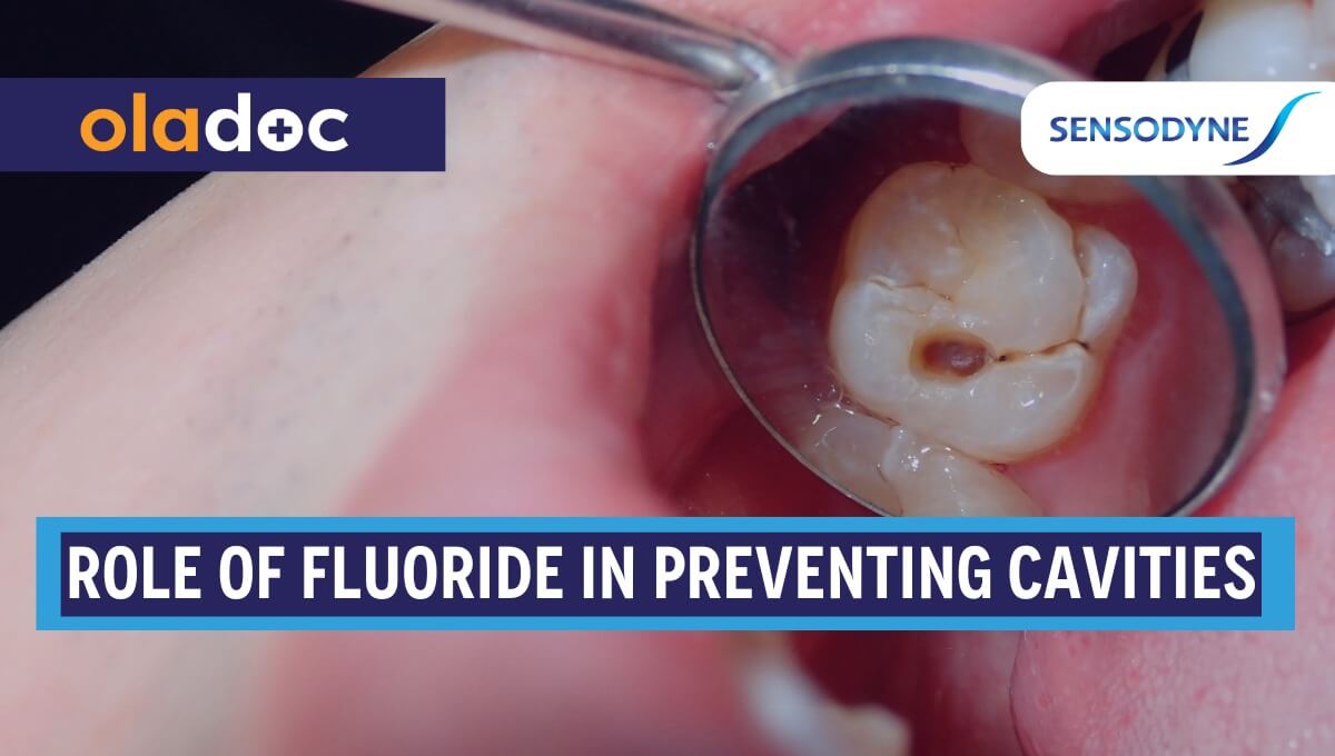 The Role of Fluoride in Preventing Cavities thumbnail