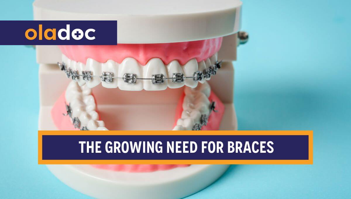 Why Is the Need for Braces Increasing in This Generation? thumbnail