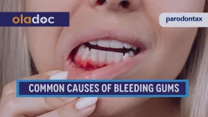 bleeding gums