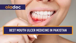 Mouth ulcer