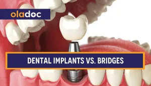 Dental implant