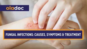Itchy skin rash on the hand due to a fungal infection