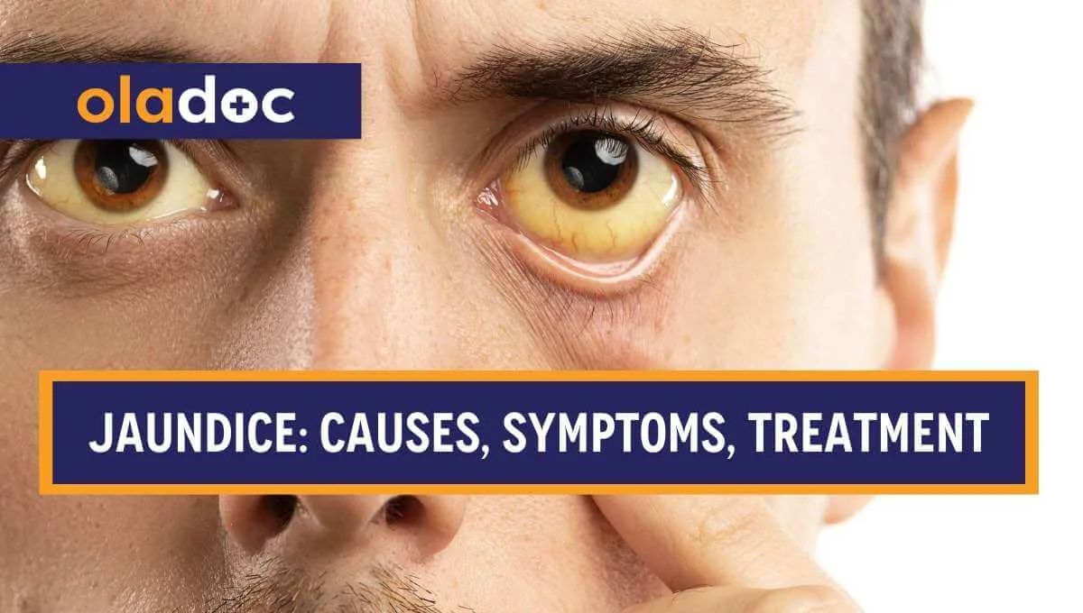 Peela Yarkan (Jaundice) – Symptoms, Causes, Treatment
