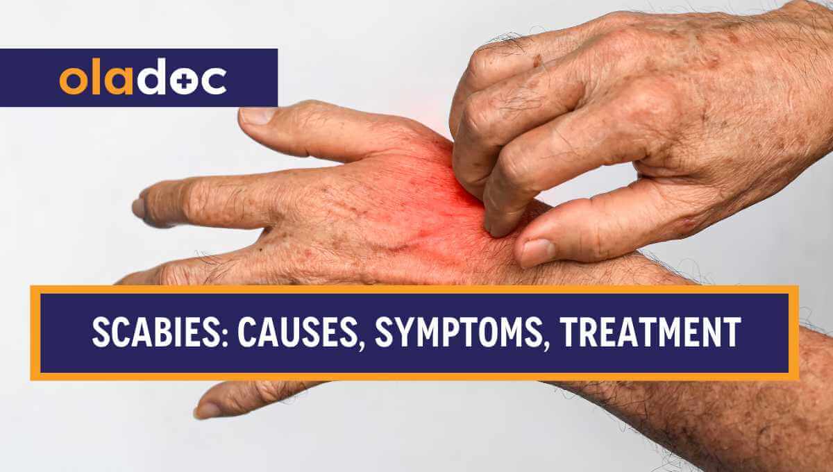 Scabies (Khushk Kharish): Causes, Symptoms & Treatment thumbnail