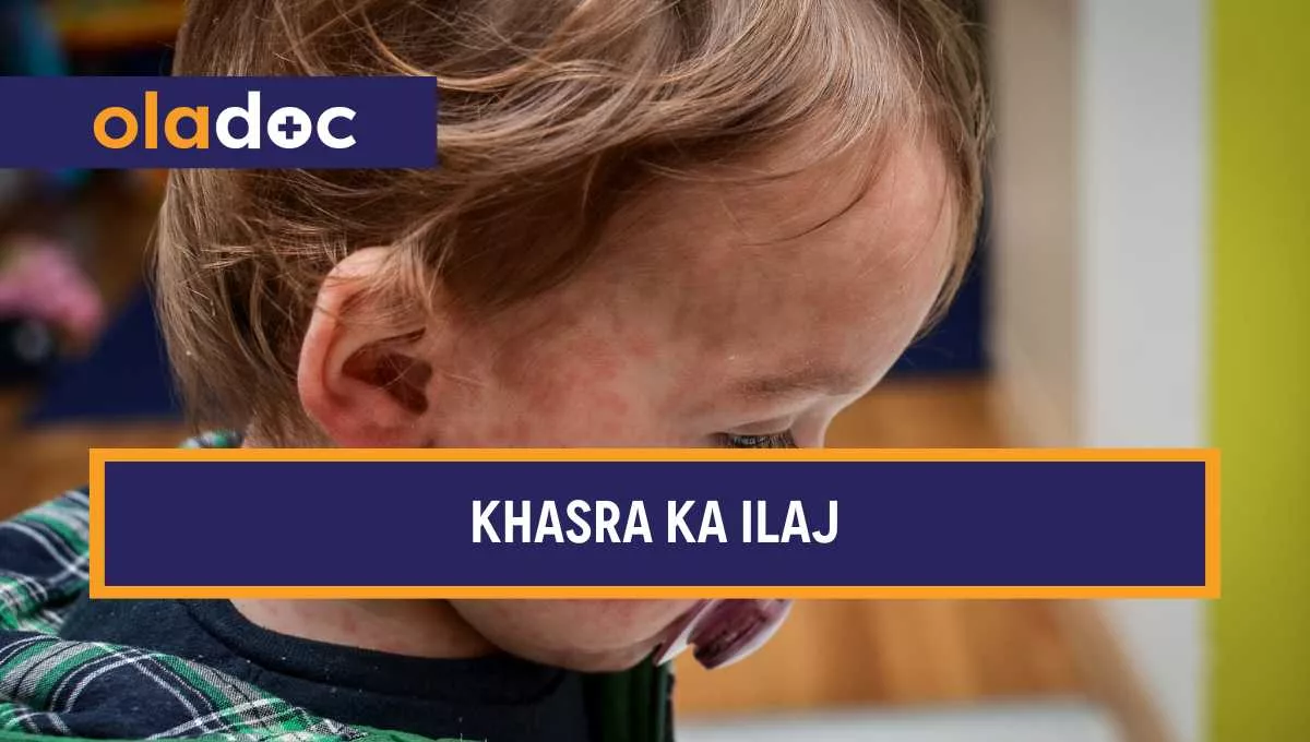 خسرہ کا علاج جانیے Khasra Ka Ilaj