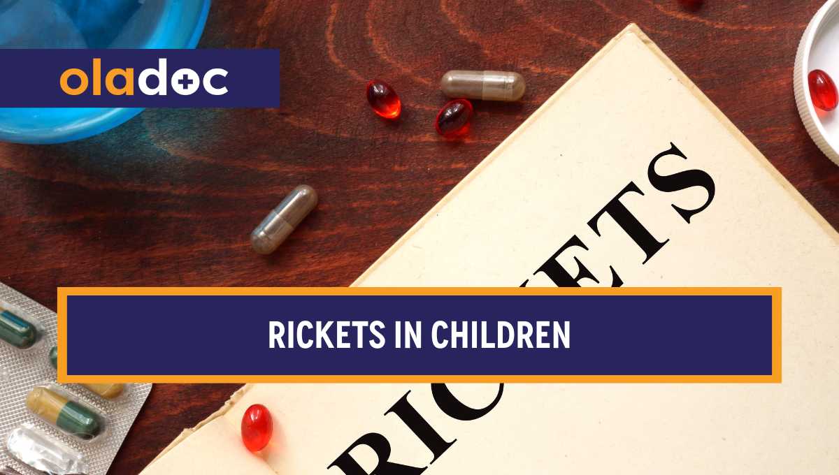 Rickets in Children: Causes, Symptoms, and Treatment thumbnail