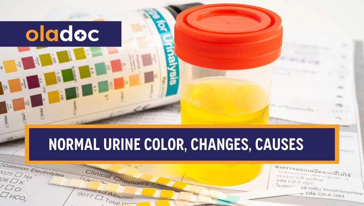 Normal Urine Color, Changes and Causes of Abnormal Urine