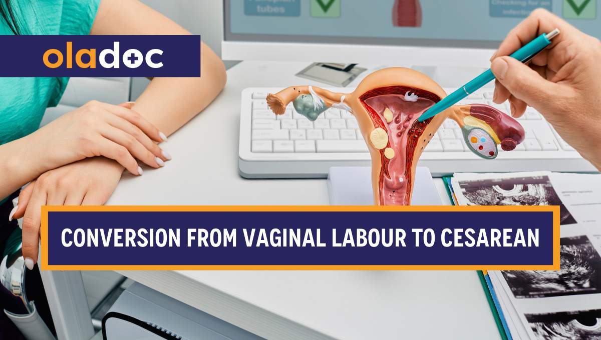 When and Why Normal Labour May Convert into a Cesarean Section thumbnail