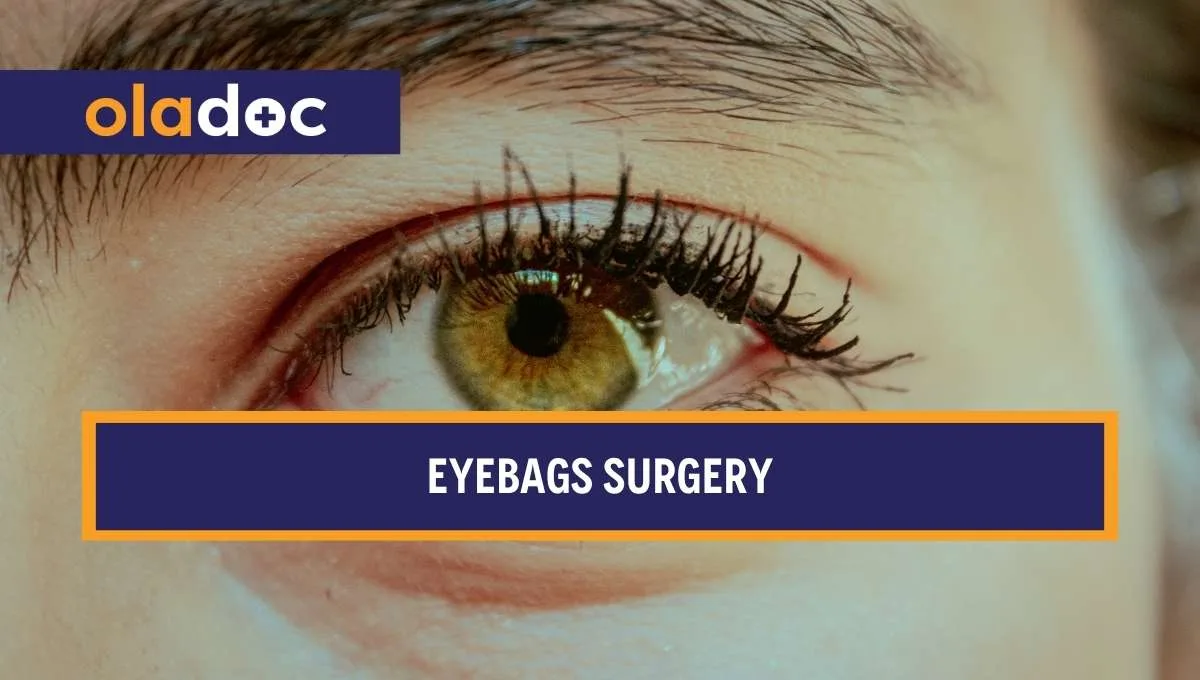 Eyebags Surgery Guide Cost Recovery and Results Explained