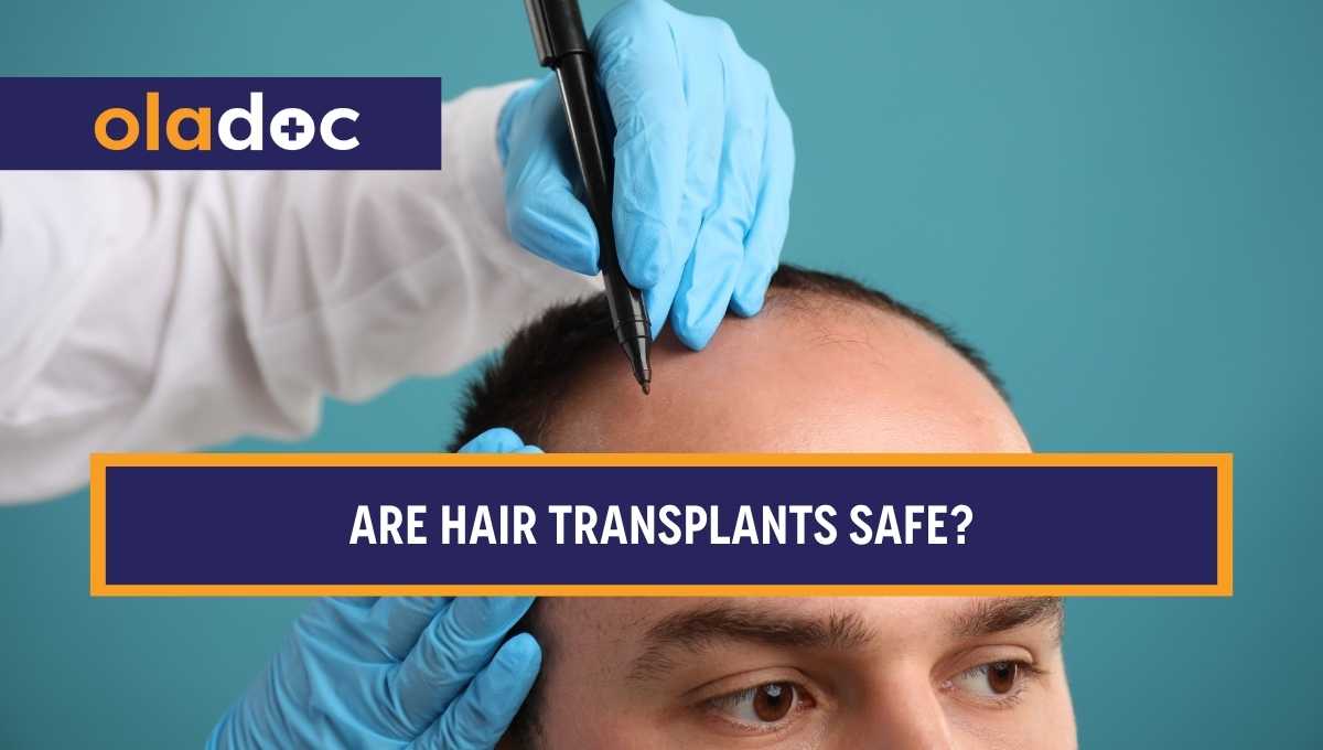 Are Hair Transplants Safe? Understanding The Risk Safety and Outcomes thumbnail
