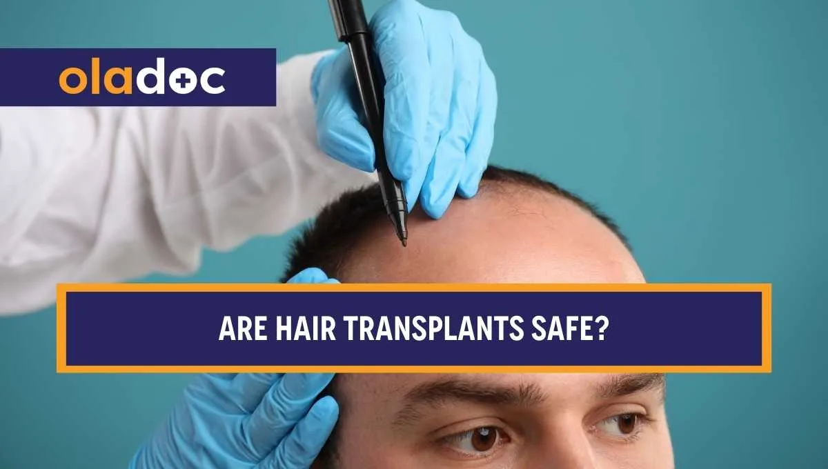 Are Hair Transplants Safe? Understanding The Risk Safety and Outcomes
