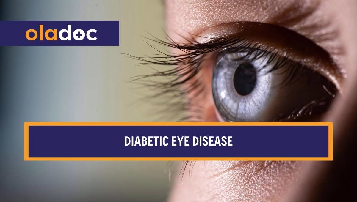 Diabetic Eye Disease: Symptoms, Causes and Treatment