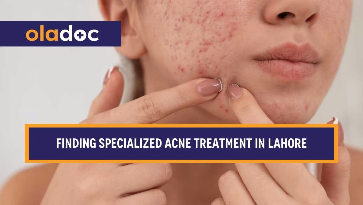 How Do I Find Specialized Acne Treatment in Lahore?