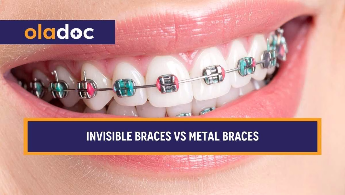 Invisible Braces vs Metal Braces: Which Should You Choose?