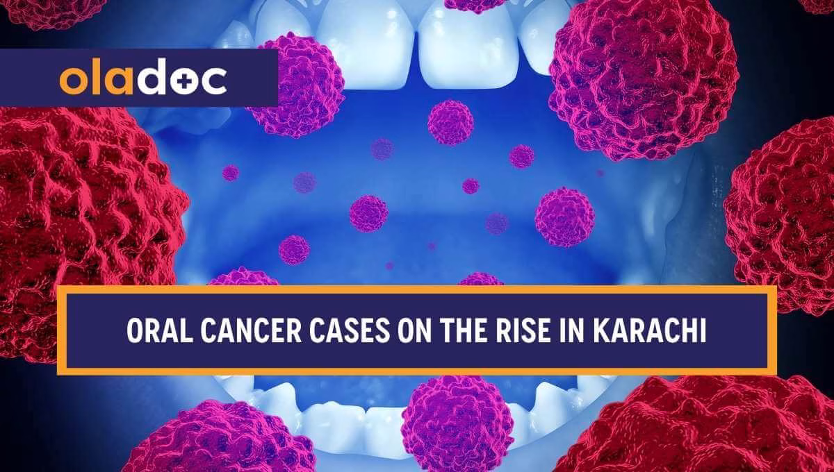 Oral Cancer Cases on the Rise in Karachi and Across Sindh