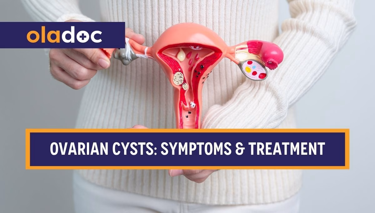Ovarian Cysts: Symptoms, Sizes, and When to Worry